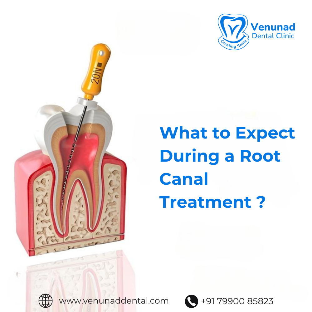 https://www.venunaddental.com.lttrbx.in/uploaded_file/files/img/news/Root Canal Treatment