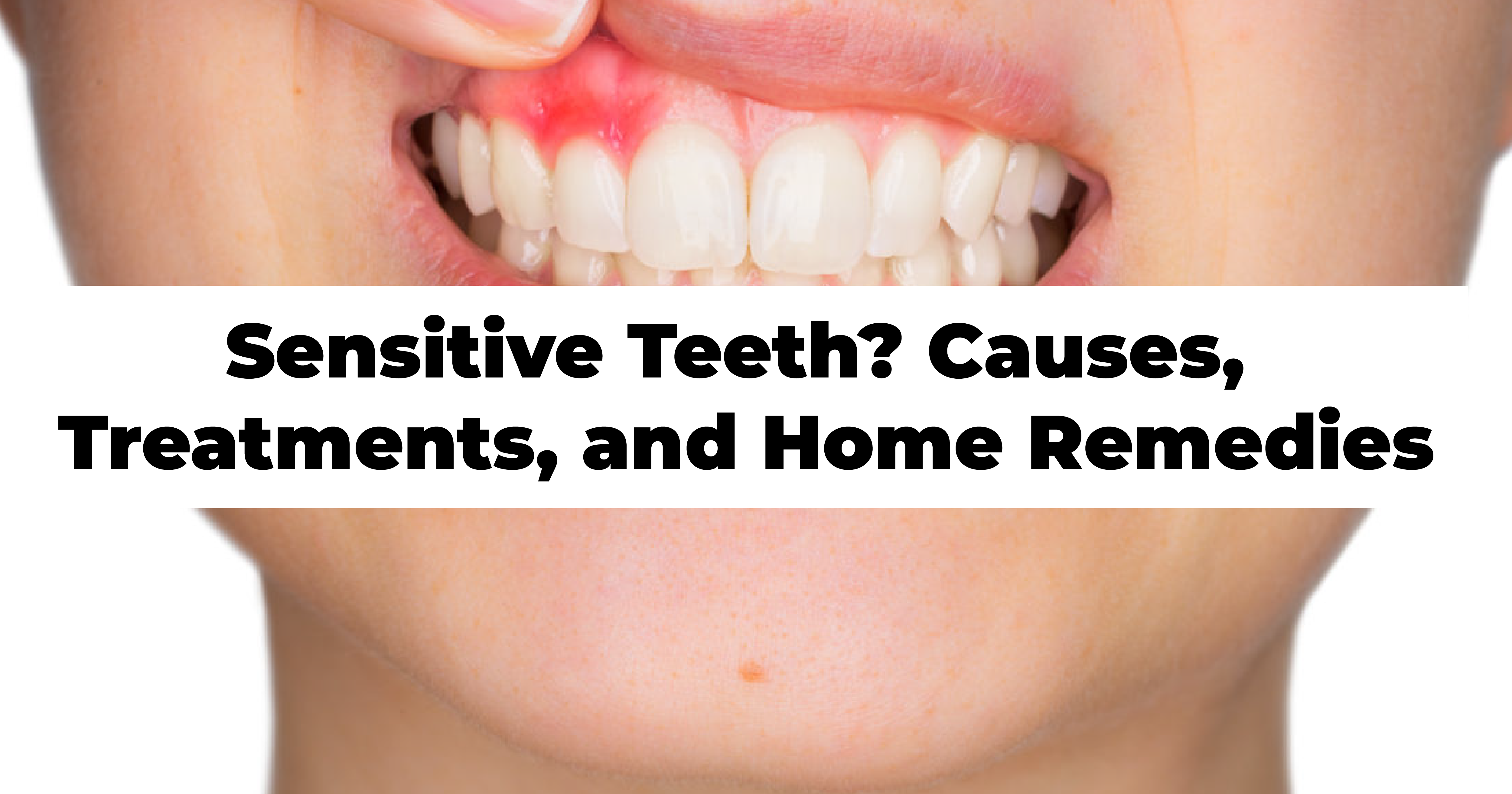 Sensitive Teeth